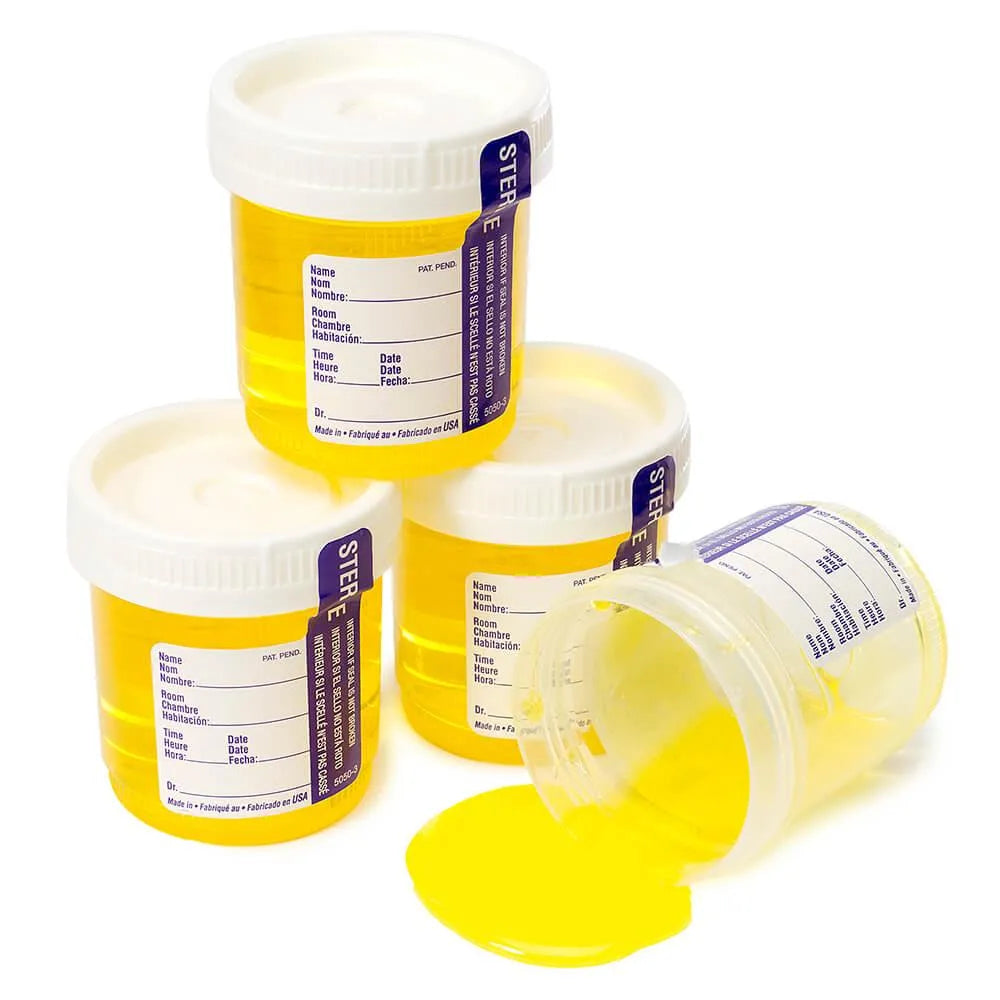 Tower of Sour Liquid Candy Urine Samples: 4-Piece Pack